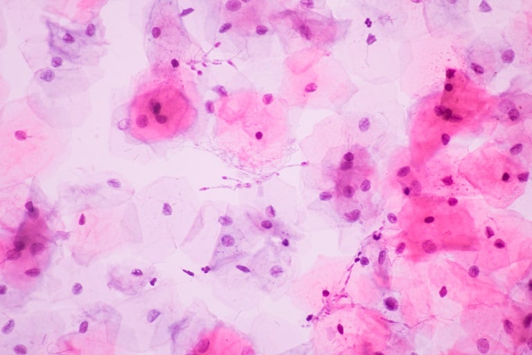 Candida albicans, ¡¿qué hongo?! featured image